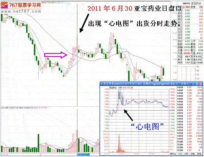 短庄与心电图分时走势