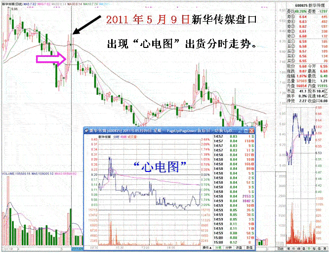 短庄与心电图分时走势
